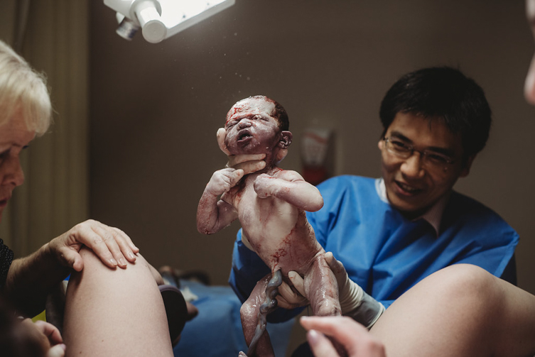 birth photography of a newborn