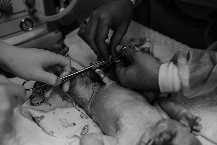 birth photos of newborn baby